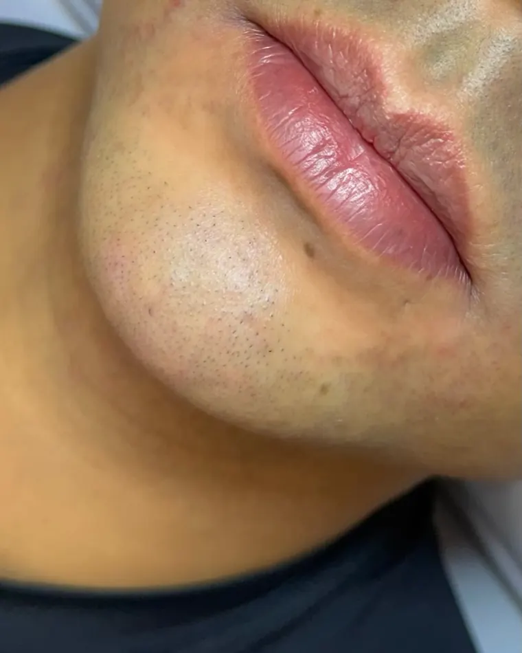 Time RC Lips: antes