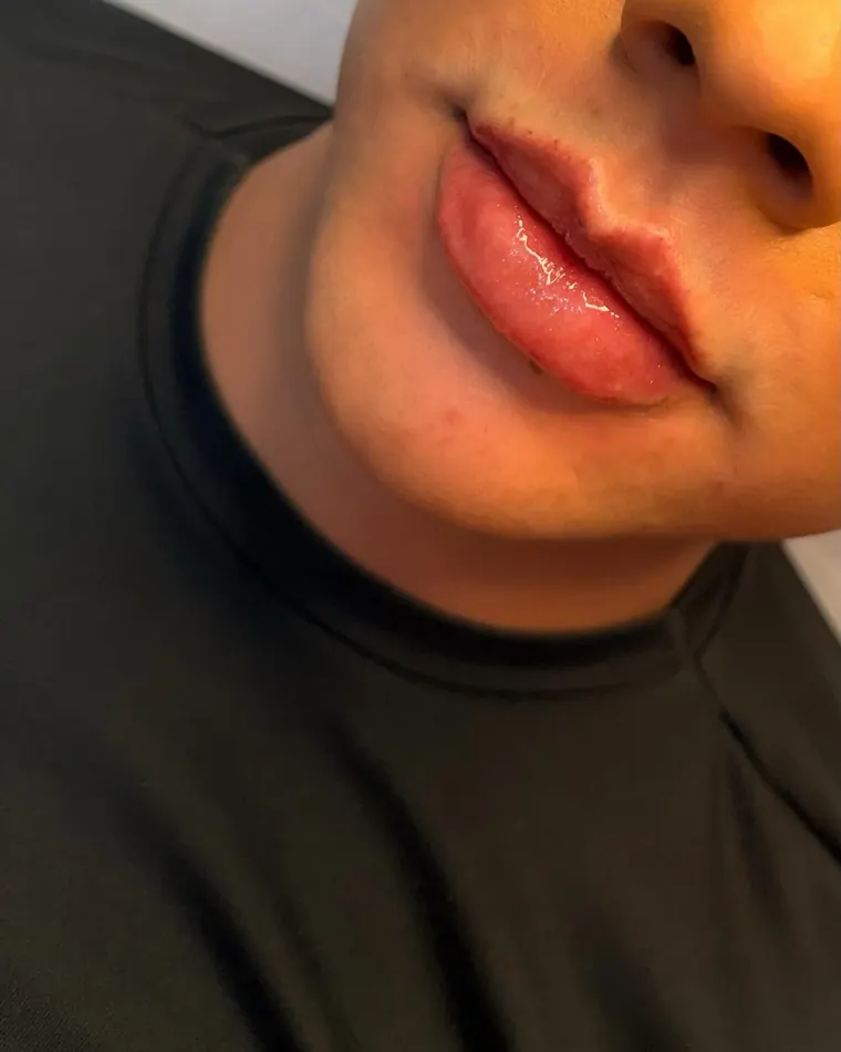 Time RC Lips: depois